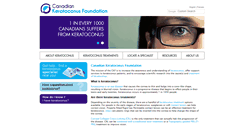 Desktop Screenshot of keratoconuscanada.org
