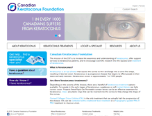 Tablet Screenshot of keratoconuscanada.org